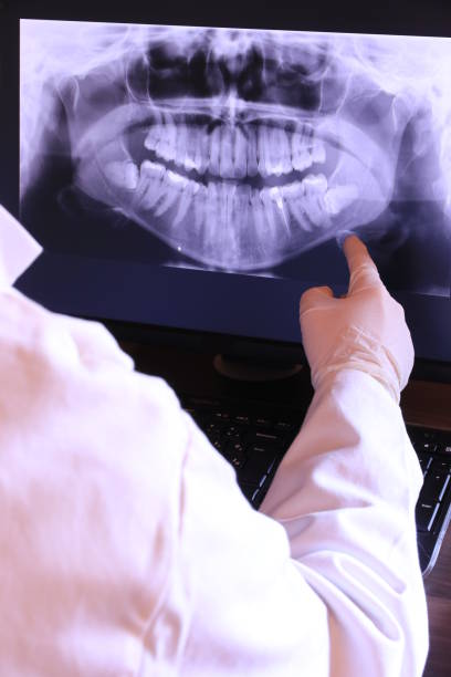 Best Emergency Dental Care for Broken or Chipped Teeth in Ellijay, GA