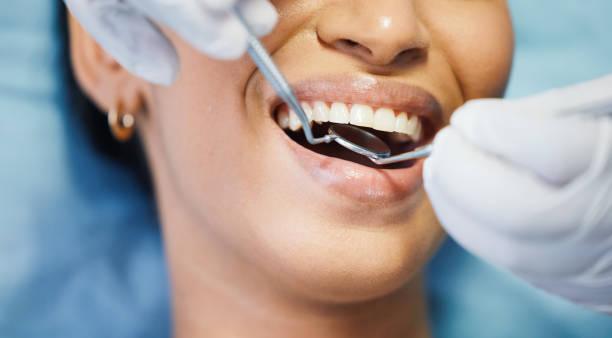 Best Emergency Treatment for Dental Infections or Abscesses in Ellijay, GA